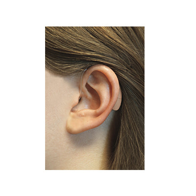 Coping with Hearing Loss Caused by Ménière's Disease