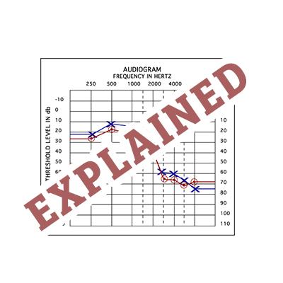 The Audiogram Explained